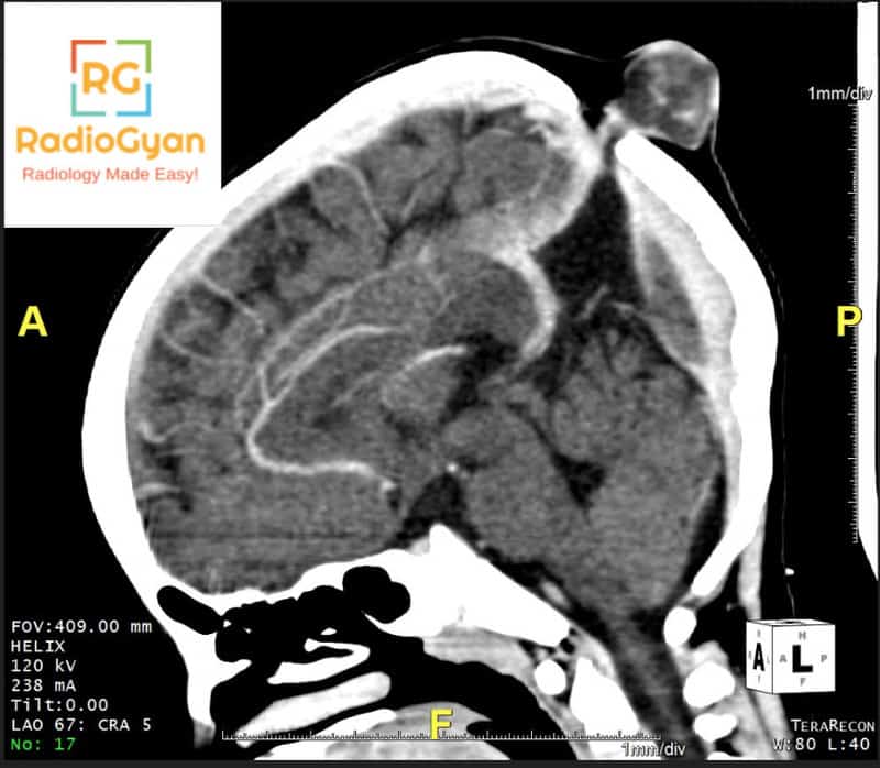Radiology spotters RadioGyan.com