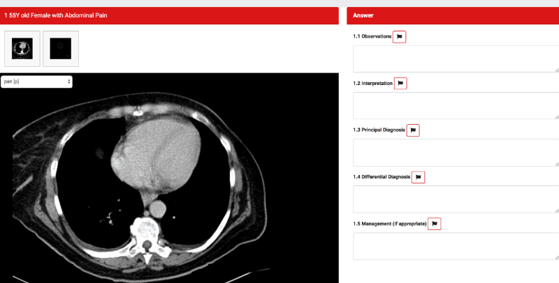 Coupon Codes? Revise Radiology FRCR courses