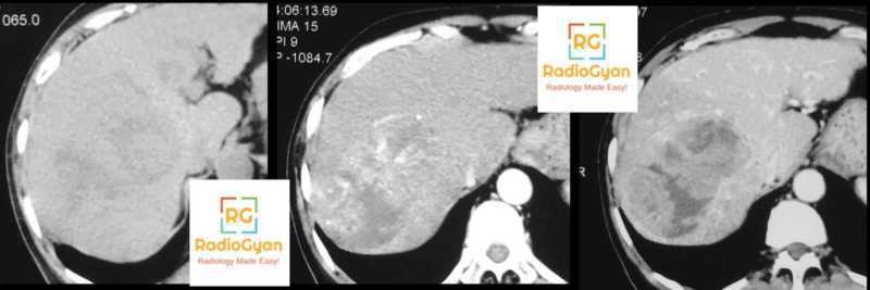 Radiology Spotters set 24 | RadioGyan.com