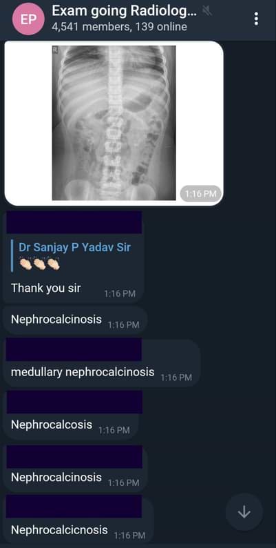 Common mistakes in radiology spotters at Sanjay radiology exam going group