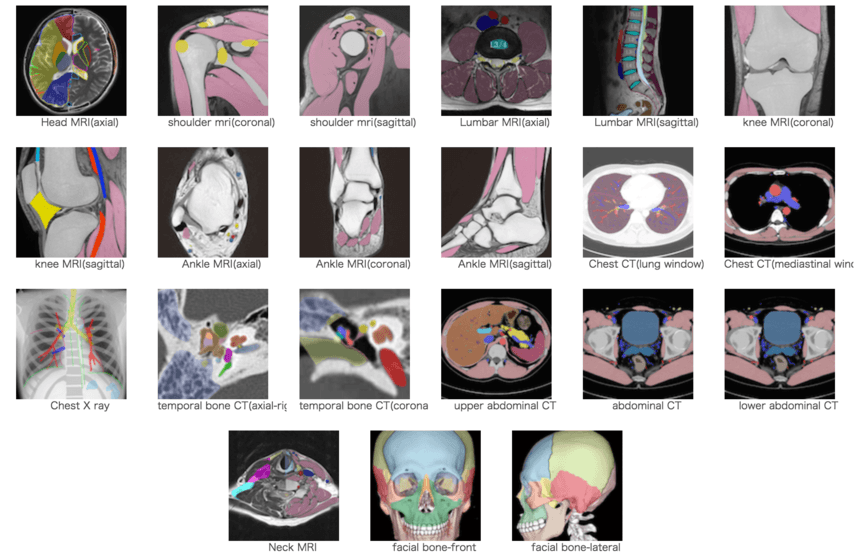 Radiological Anatomy