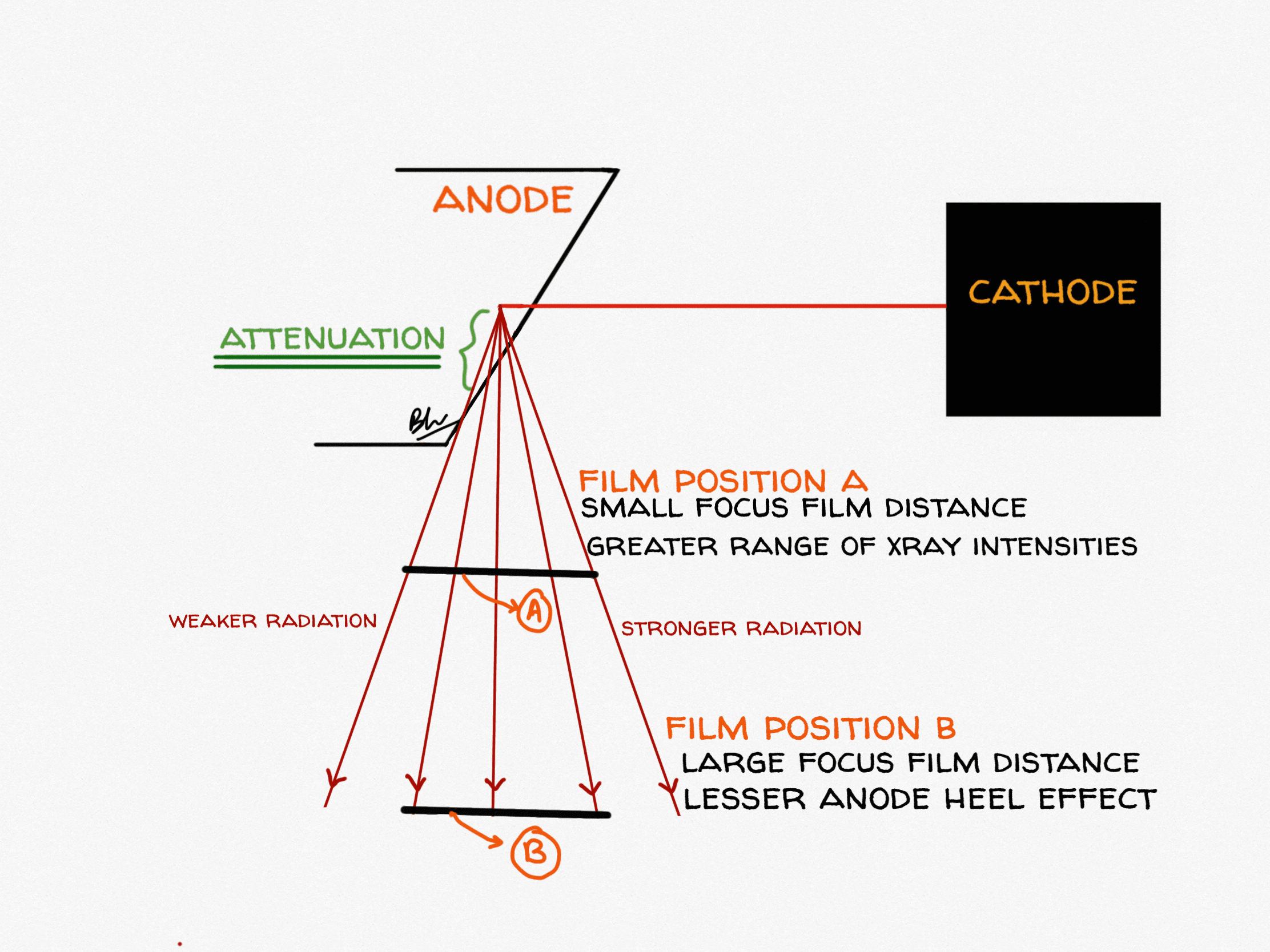 Anode heel effect'' on patient dose in lumbar spine radiography