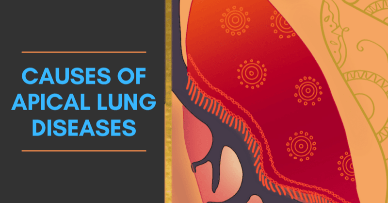 Apical Lung Diseases Mnemonic