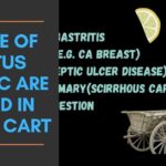Causes Of Linitus Plastica are Found in a Lemon Cart