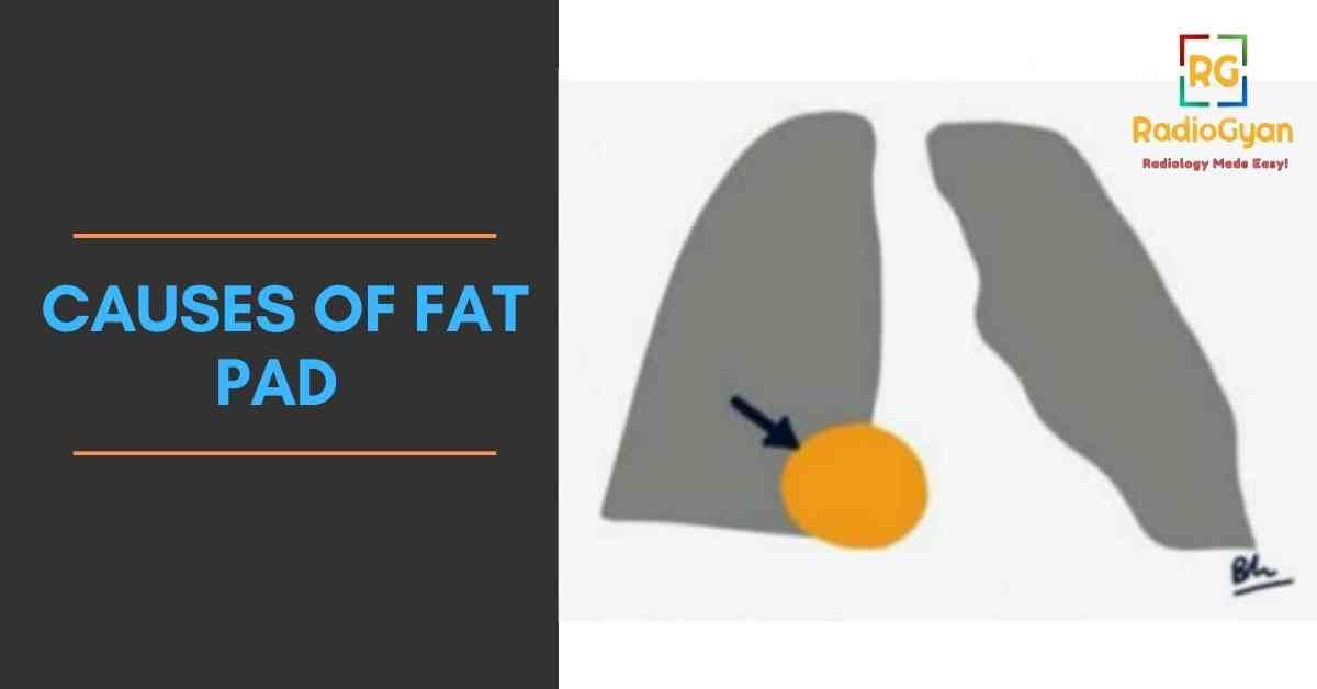 causes of Fat Pad