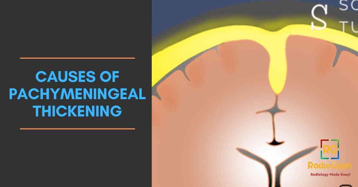 causes of Pachymeningeal Thickening