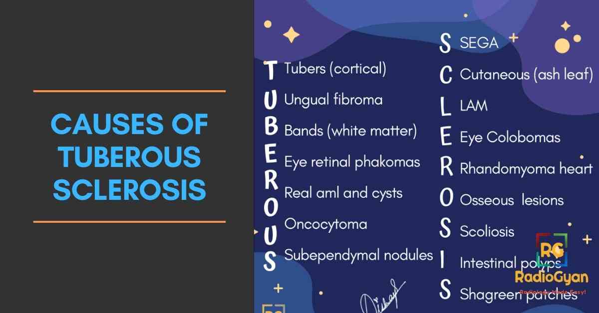 causes of tuberous sclerosis