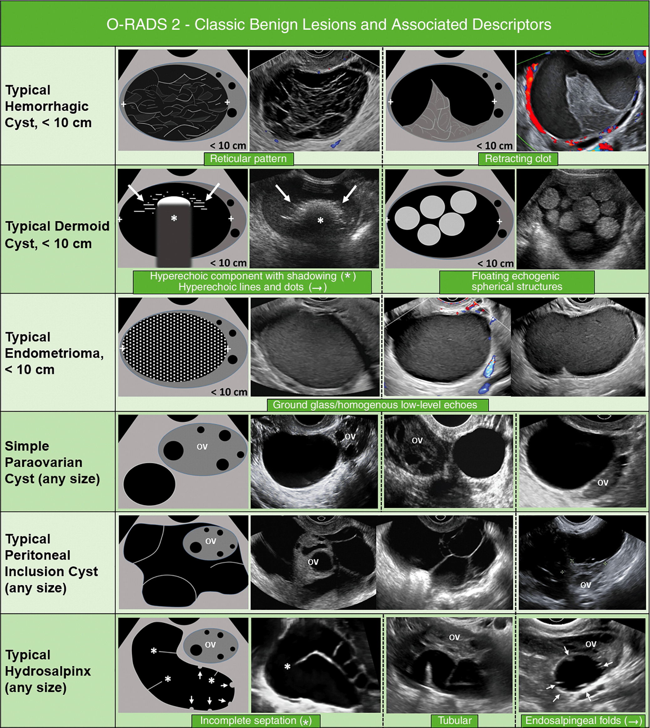 o-rads-ultrasound-calculator-radiogyan